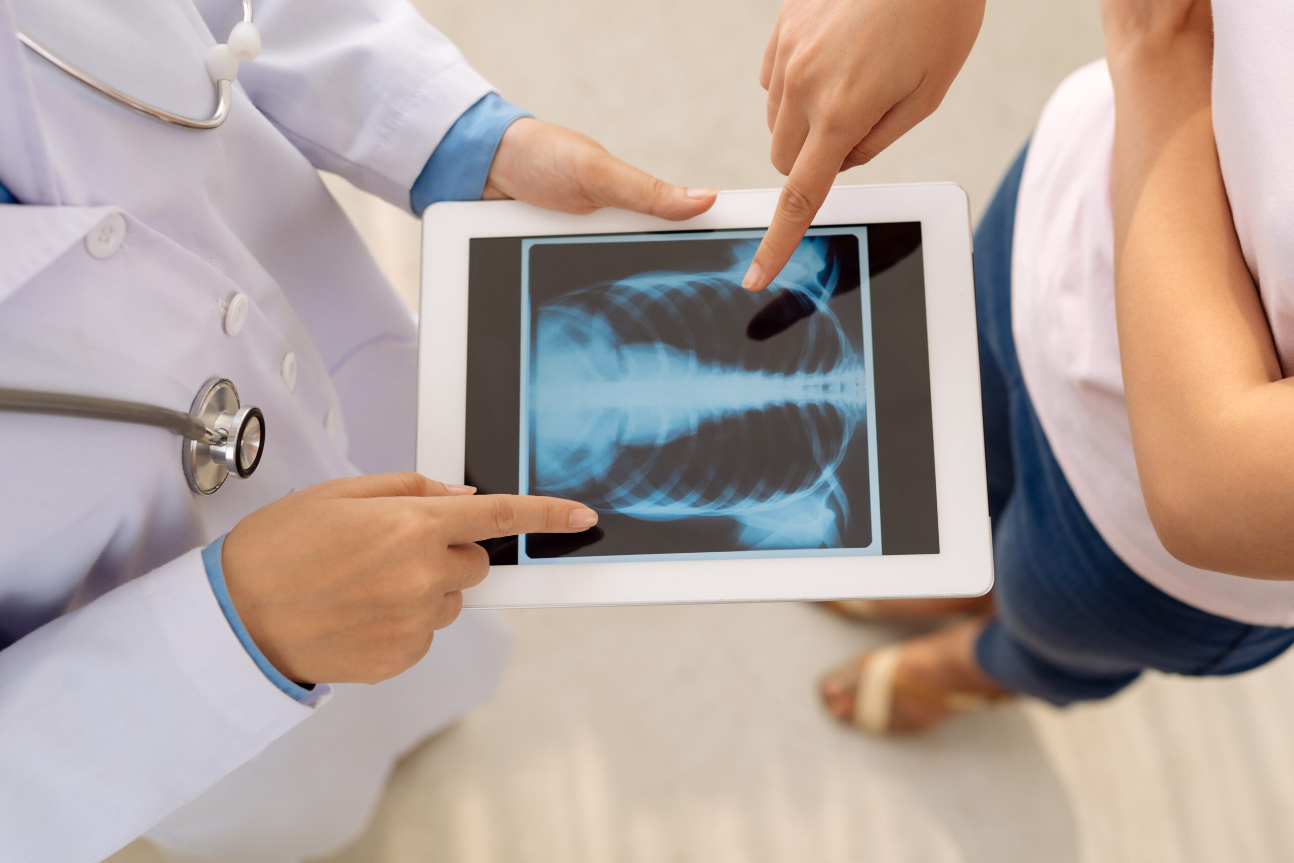 Doctor showing chest x-ray on digital tablet to female patient, view from above